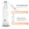 Ultrasonic Skin Scrubber Deep Pore Cleaning Blackhead Remover Vacuum Electric Facial Massager Eye Beauty Device Face Lifting 4