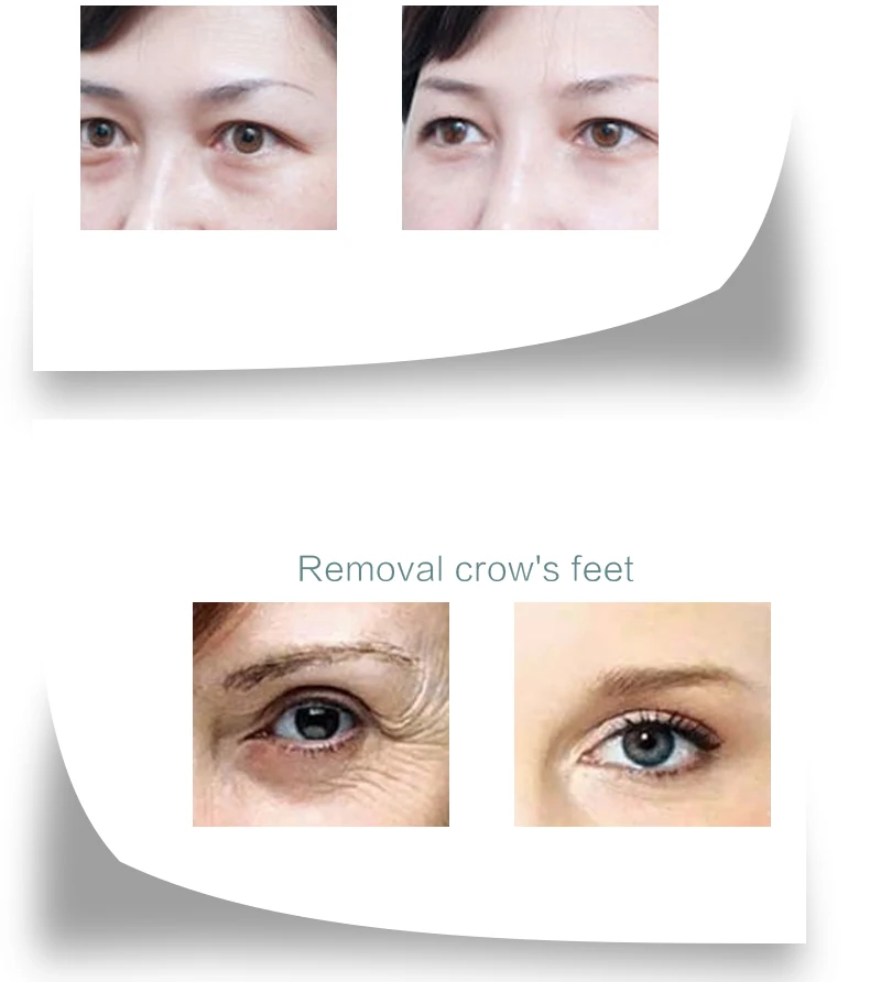 祛袋祛纹持久清润眼霜英文_08