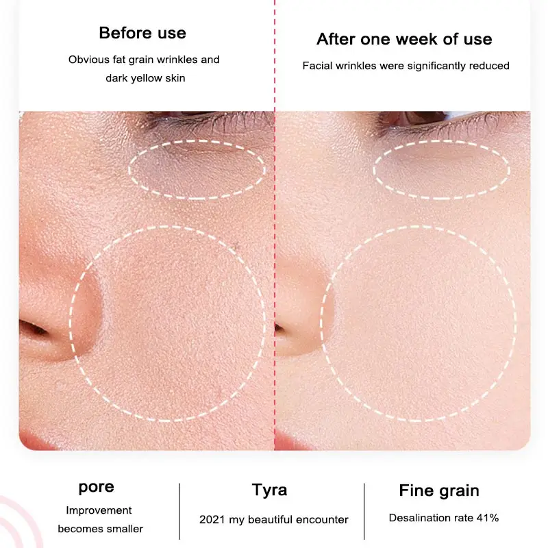 Hot and cold iontophoresis facial beauty ion rejuvenation cleansing cleansing household beauty instrument