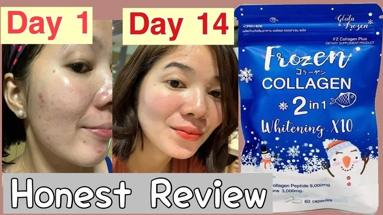 6 1pack Thailand Frozen Collagen By Gluta Reduce Dark Spots And Acne Whitening Skin 60 Caps Pack Aliexpress