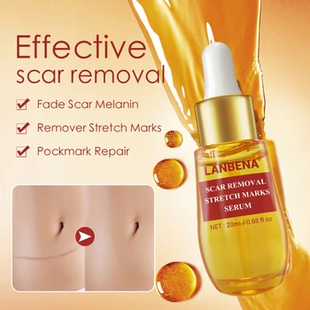 

Stretch Mark Remover Scar Cream Whitening Cream Acne Treatment Scar Repair Skin Care Body Cream Bio Oil Skin Care