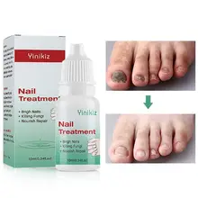 Жидкость для восстановления ногтей, травяная, для ногтей, антибактериальный раствор, стерилизация, Лечение ногтей, средство для удаления онихомикоза, грибок T8W5