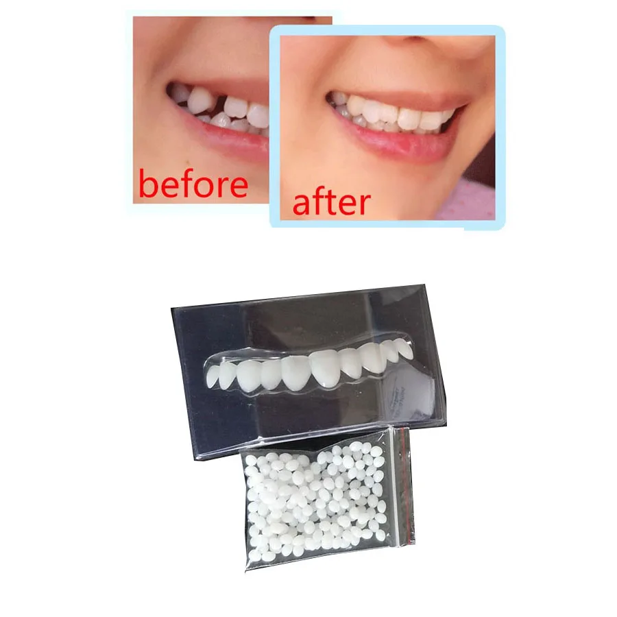 

Temporary Tooth Repair Set kit Teeth Solid Glue Gap Falseteeth Solid Glue Denture Adhesive Teeth Dentist
