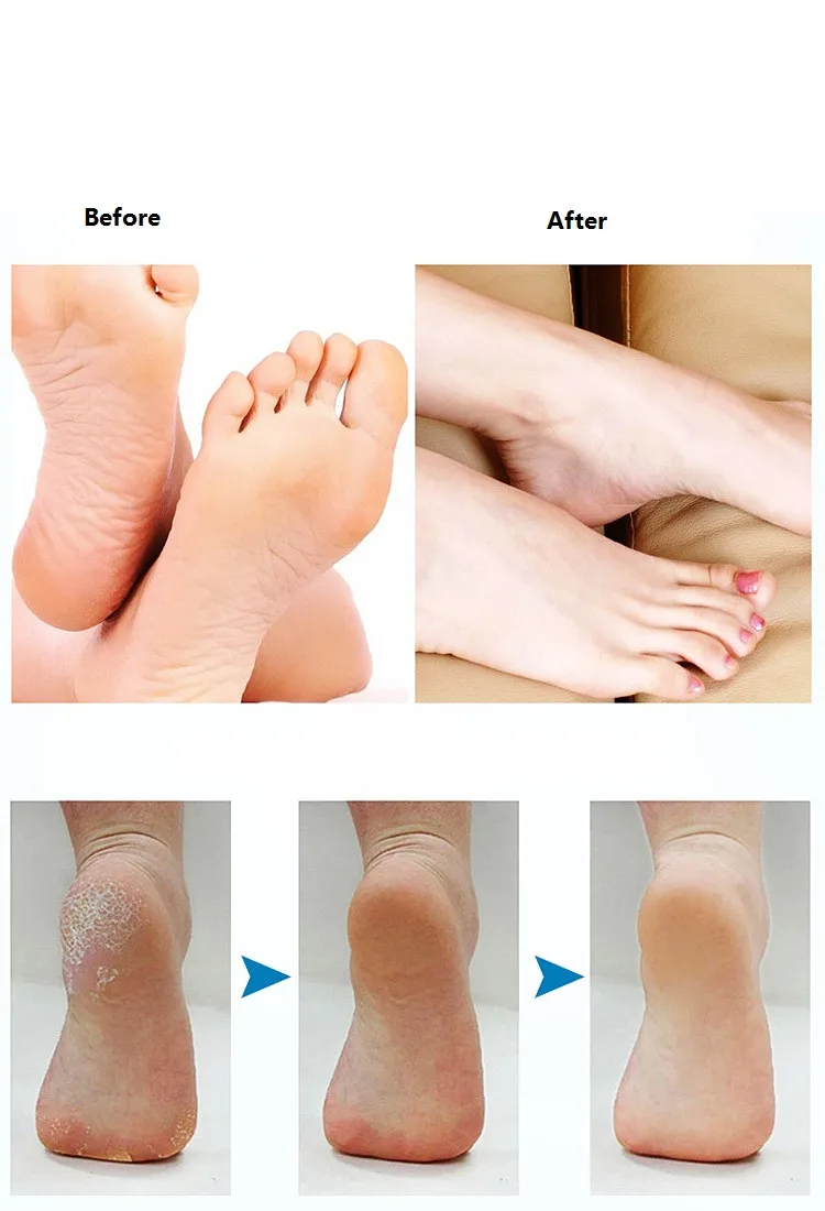 TB2r1owmpXXXXcfXXXXXXXXXXXX_!!49201468