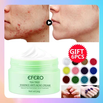

efero Anti Acne Scar Removal Cream Face Cream Anti Aging Wrinkle Cream for Face Pimple Blackhead Whitening Oil Control Skin Care