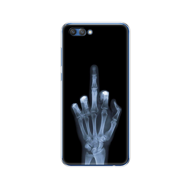 case for huawei honor V10 VIEW 10 soft tpu back phone cover for huawei honor 10 VIEW 10 Etui protective printing coque