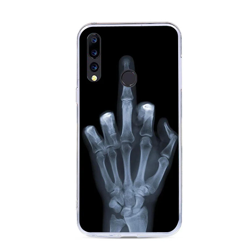 Чехол CALROVTE Для Doogee N20 Wolf чехол из силикона и ТПУ Для Doogee N20 Кошка Животное оболочка сумка корпус чехол для телефона для N 20 - Цвет: 48