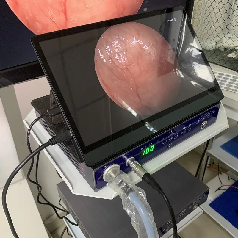 Рисунок 3 - Эндоскопический источник света 60 Вт с камерой Full HD