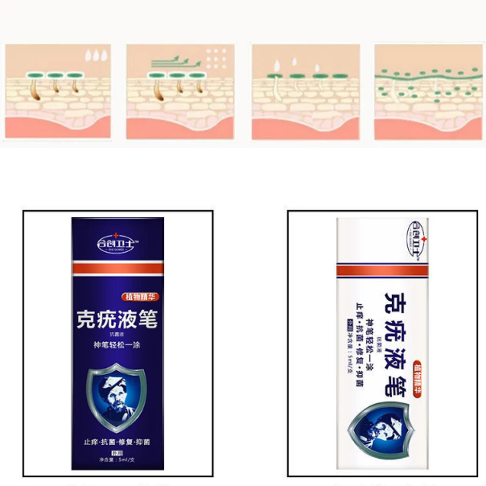 Крем для удаления мозолей ног 5 мл мазь ухода за кожей подошвенными гениталиями