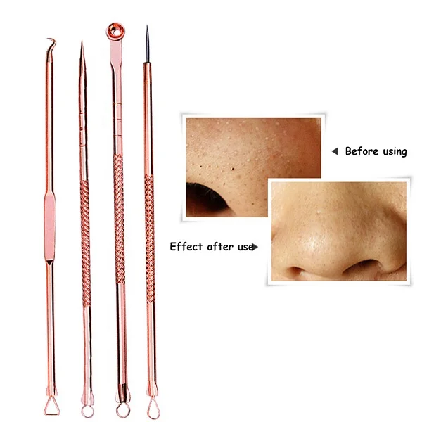 4PCS Style 3 1 Набор для удаления угрей, акне, иглы из нержавеющей стали, прыщи, пятнышко, Комедон, экстрактор, очищающее средство, уход за лицом, косметические инструменты - Цвет: 4PCS Style 3