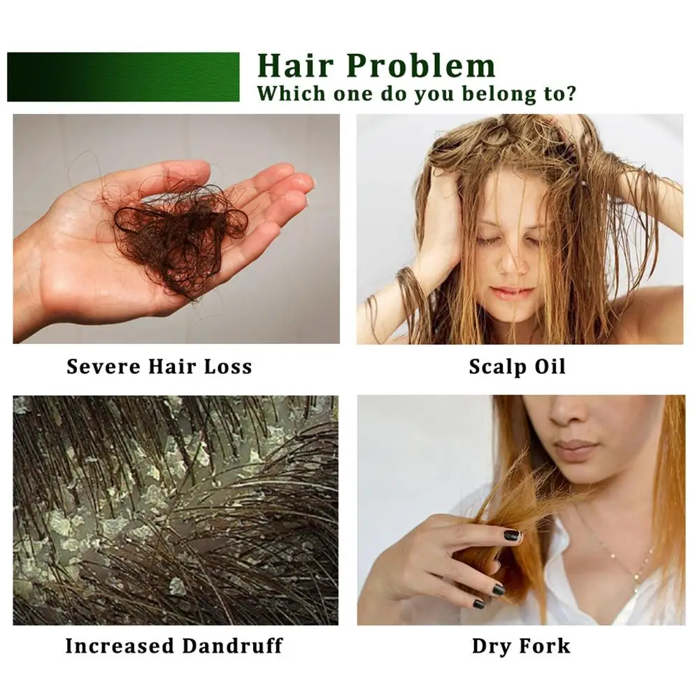Сыворотка для быстрого роста волос Имбирь эфирное масло против потери волос жидкость для восстановления поврежденных волос для роста женщин и мужчин