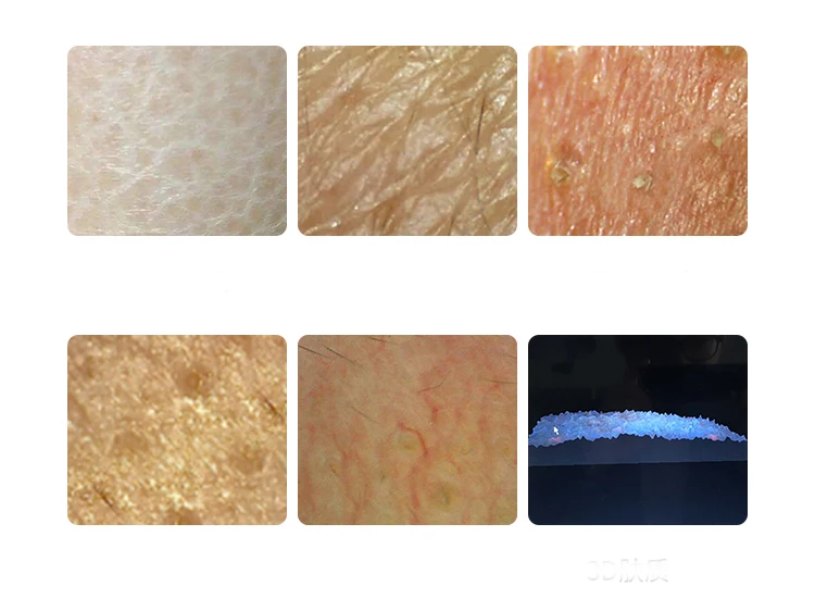 Intelligent skin detector beauty salon face intelligent analysis skin moisture management instrument beauty salon dedicated