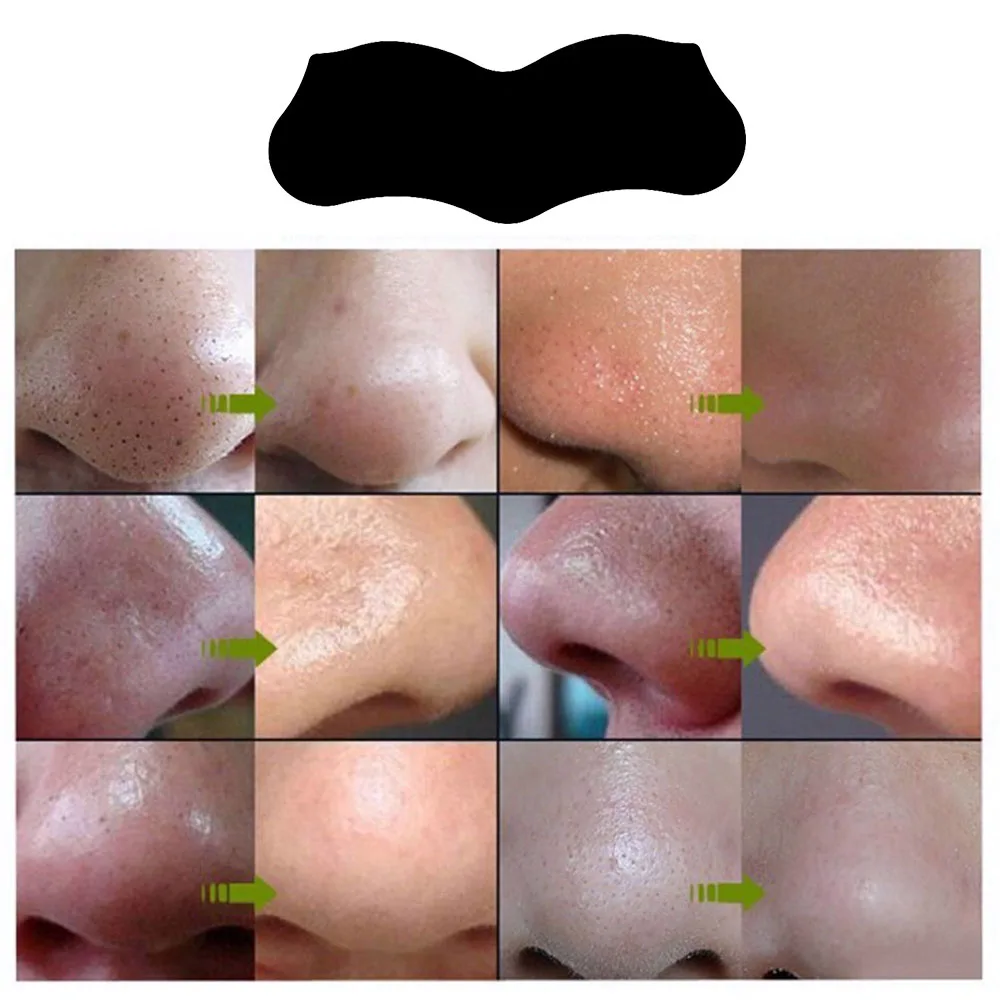 10pcs Face Skin Care Nose Sticker Remove Blackhead Acne Remover Mask Clear Black Head 3 Step Kit Deep Nose Pore Cleasing Strips 1