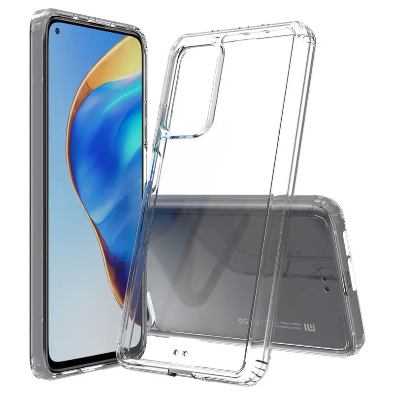 

XiaoMi 10T Pro Case Fashion scratch proof Acrylic Protection Shockproof Back Cover For XiaoMi 10T Pro Silicone Frame Phone Cases
