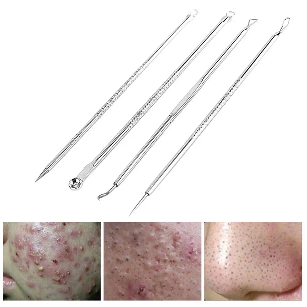 4 шт./компл. набор инструментов для удаления черных точек прыщей|Устройство ухода