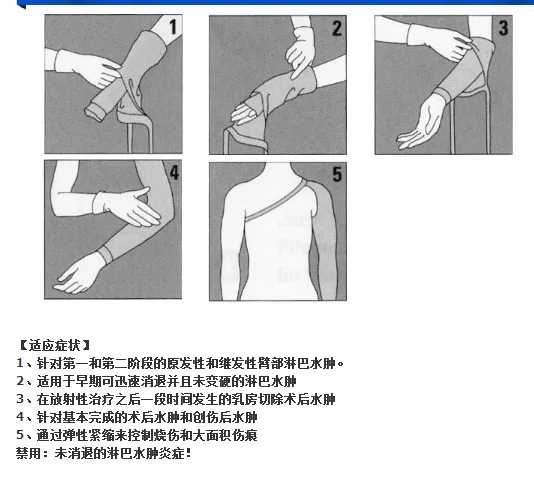 

Tubular Bandage Upper Limb Lymphedema Elasticity Cuff Wrist Protector Shoulder Pad Anti-Breast Postoperative Plaster Arm