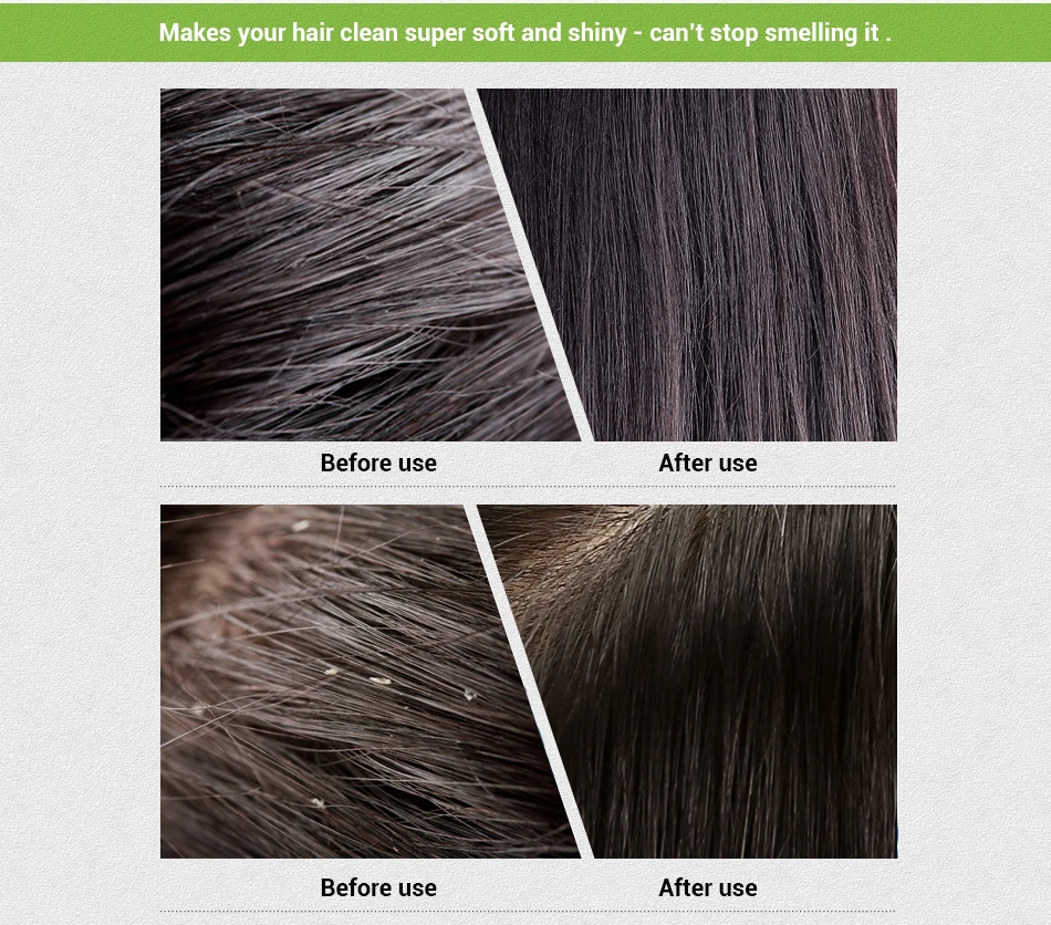 洗头皂详情页_07