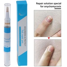 Лидер продаж, 1 шт., ручка для лечения грибка для пальцев ног, китайский травяной антигрибковый Уход за ногтями