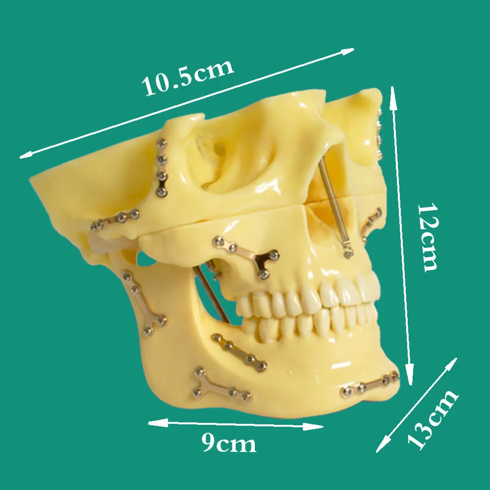 

1 Piece Dental Orthodontic Implanting Anchorage Teeth Model for Teaching and Communication