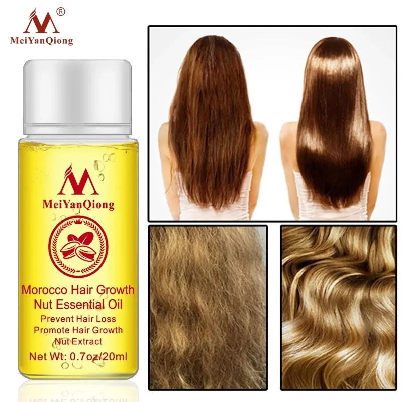 Crescita rapida Potenti prodotti essenziali Olio essenziale Trattamento liquido Prevenzione della perdita Cura dei capelli_voghion.com