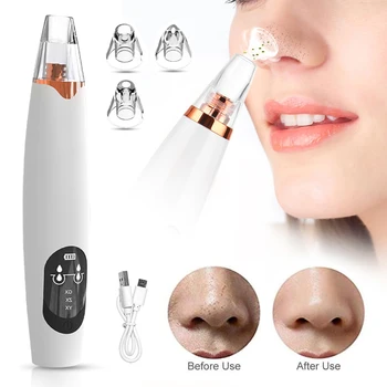 

Electric Blackhead Remover Extractor Tool Black Spots Acne Suction Machine Facial Pore Cleaner Dropshipping Center Beauty Tool