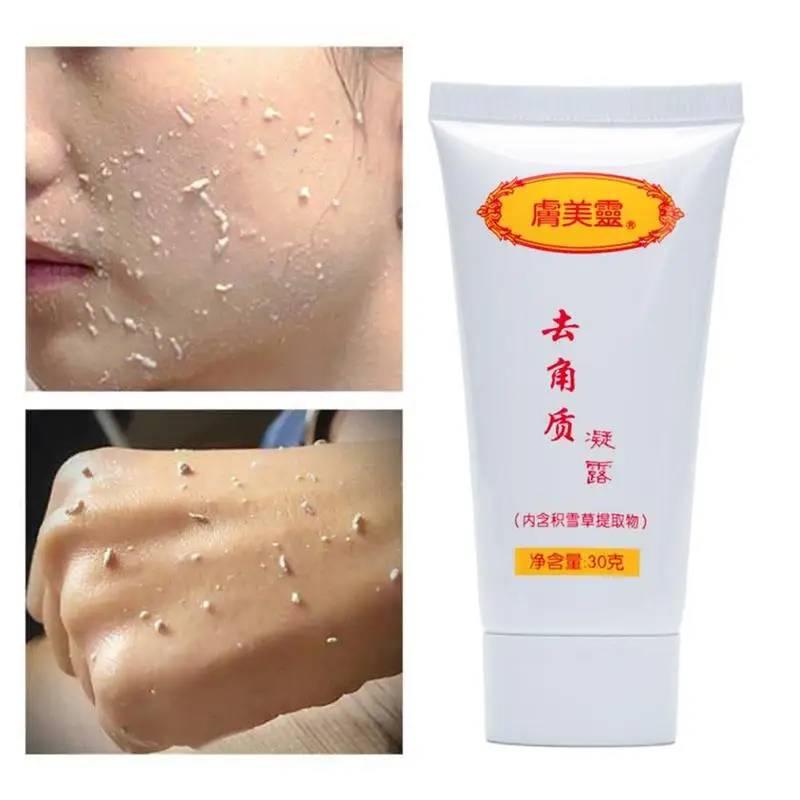 Scrub Ginger Exfoliating Gel Hyaluronic Acid Cleanser Nourishing Cleanser  Moisturizing Face Wash Anti-spot Gel - Facial Scrubs & Polishes - AliExpress