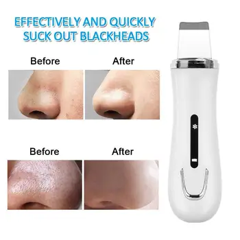 

Clean Clear Whitening Black Head Cleaner Skin Scrubber White Ultrasound EMS Blackhead Removal Equipment Fast Effective Tira