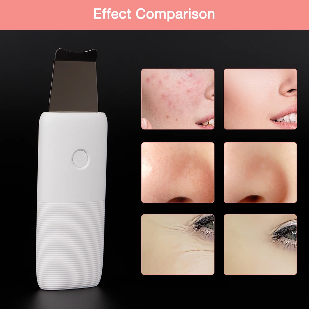  Portable Ultrasonic Skin Scrubber Facial Pore Cleaner Massage Ultrasonic Deep Cleaning Machine Rech