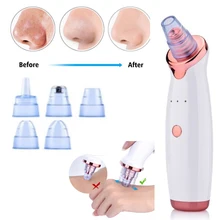 Очиститель пор для удаления черных точек вакуумный Электрический Нос лицо глубокое очищение кожи уход машина подарок на день рождения дропшиппинг красота инструмент