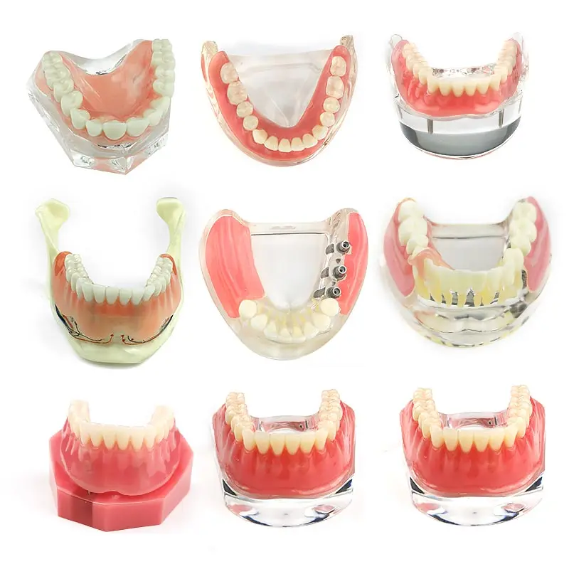 

Dental Overdenture Teeth Model Removable Interior Mandibular with Implant for Tooth Teaching Study
