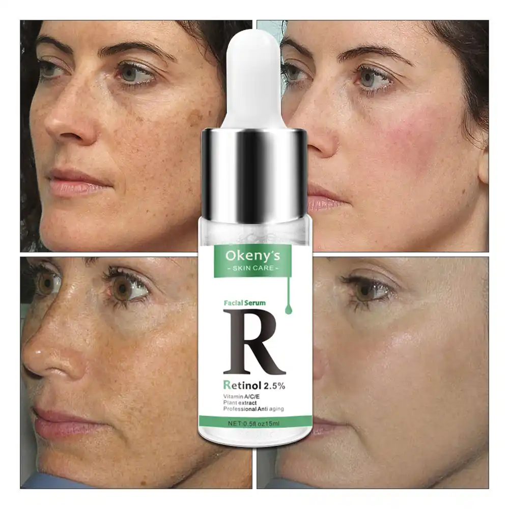 okeny's retinol