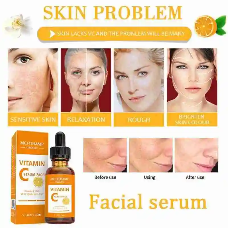 Hbdc3a4691aa54ed19ac9fdb45673559c7 100% Pure Vitamin C Serum Liquid Freckle Remove Acne Dark Skin Hyaluronic Face Serum Care Spot Acid Fade Anti-Wrinkle Scars N9X5