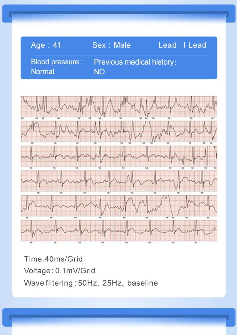 2018 P3Plus blood pressure wrist band heart rate monitor PPG ECG smart bracelet Activit fitness tracker intelligent wristband (4)