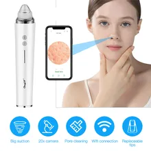 

CkeyiN WiFi Blackhead Remover Kit Phone Readable USB Rechargeable Blackhead Acne Comedo Extractor Face Care Vacuum Beauty Tool
