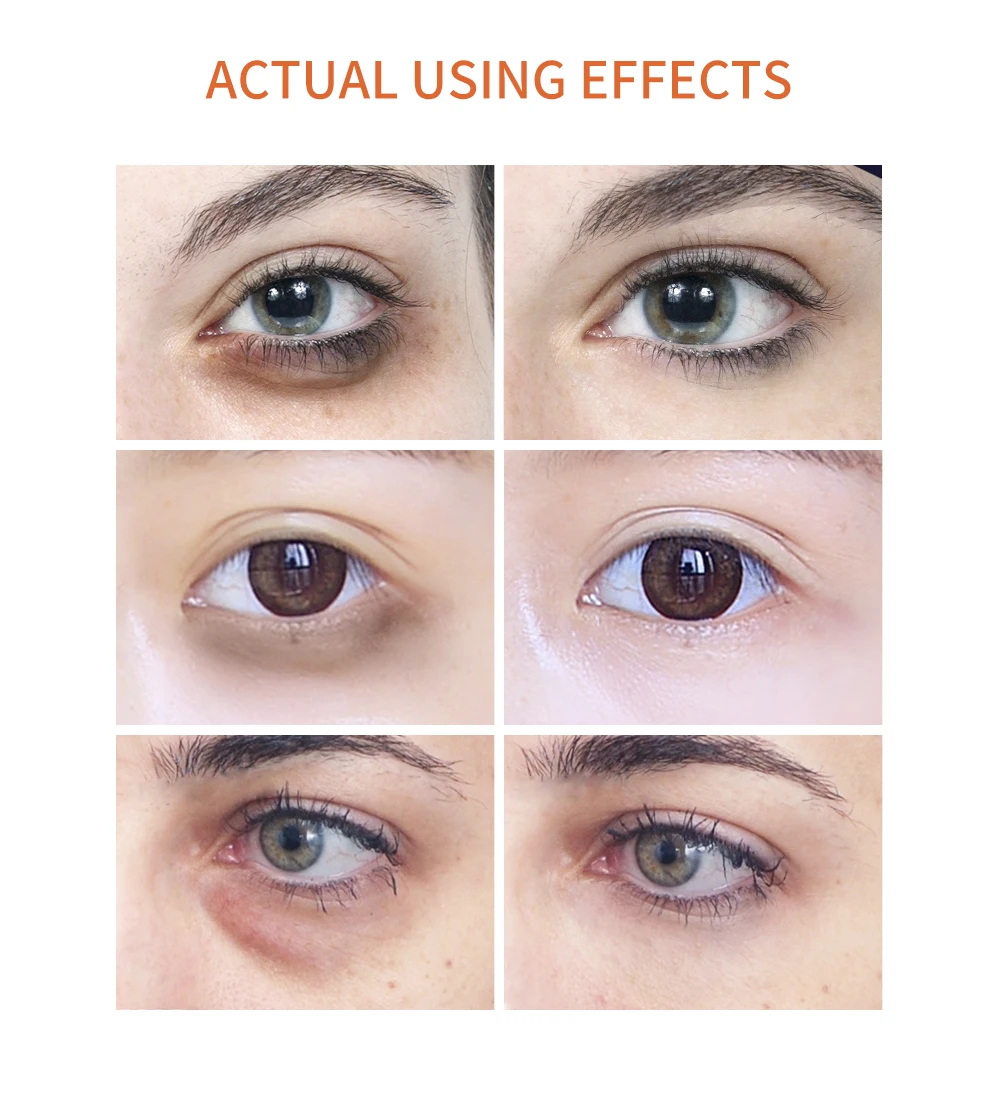 Breylee Vitamin C Eye Serum Eye Rolle Skin Care Whitening Remove Melanin Dark Circles Anti-Oxidation Moisturizing Eye Care 15Ml 5 Breylee Vitamin C Eye Serum Eye Rolle Skin Care Whitening Remove Melanin Dark Circles Anti-Oxidation Moisturizing Eye Care 15Ml