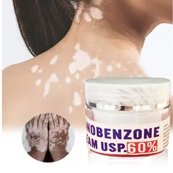60% MONOBENZONE WHITE FACE WHITENING CREAM FADES SKIN TONE CLEARS BLEMISHES & AGE SPOTS