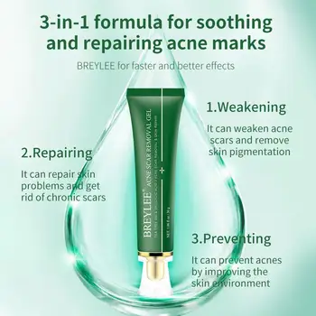 

30ml BREYLEE Acne Scar Removal Essence Cream Removal Soothing Prevent Spots Gel Acne Skin Pigmentation Treatment I2Q3