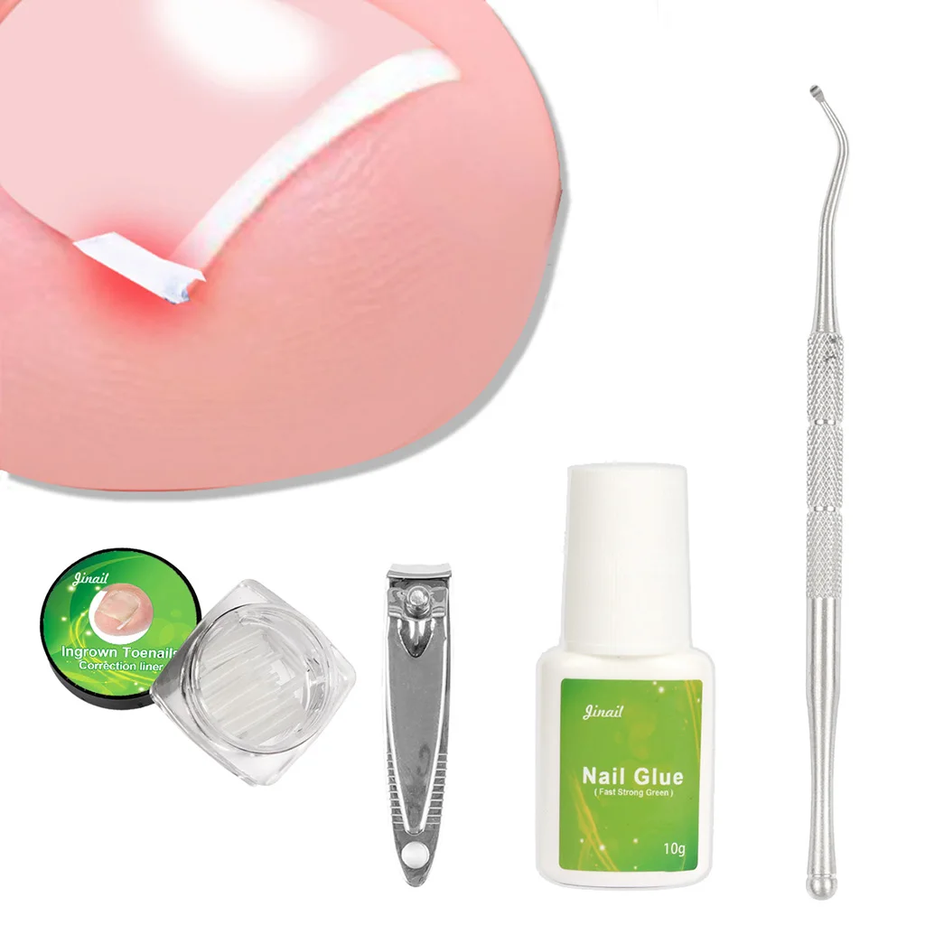 Toe Nail File Foot Nail Care Ingrown Double Ended Ingrown Toe Correction Lifter File with Glue Manicure Pedicure Toenails Tool