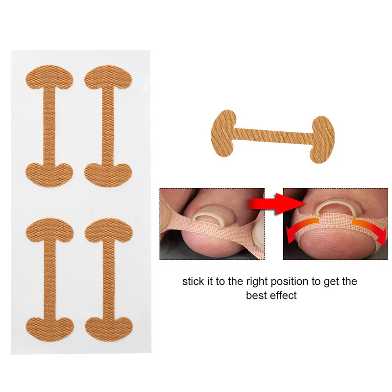 

8 Pcs Ingrown Toenail Corrector Stickers Fingernail Paronychia Treatment Toe Nail Care Repairing Corrector Pedicure Tools