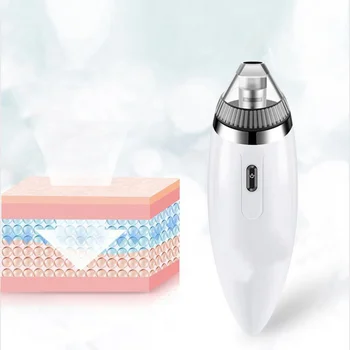 

Ultrasonic Face Skin Scrubber Facial Cleaner Peeling Vibration Blackhead Removal Exfoliating Pore Cleaner Tools (Black)