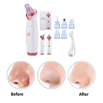 

Electric blackhead remover instrument beauty instrument blackhead cleaning pore cleaner suction blackhead's beauty's instruments