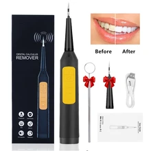 Electric Sonic Dental whitener Scaler Teeth Whitening kit teeth Calculus Tartar Remover Tools Cleaner Tooth Stain Oral Care