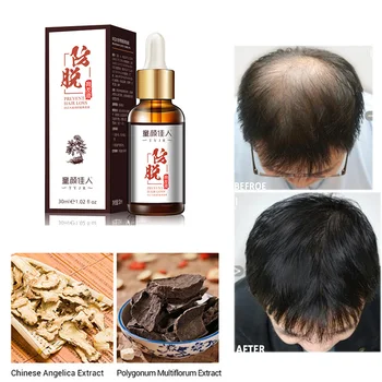 

Hair Growth Liquid Fast 30ml Increase Nutrition Beauty Effective