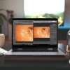 Laptops