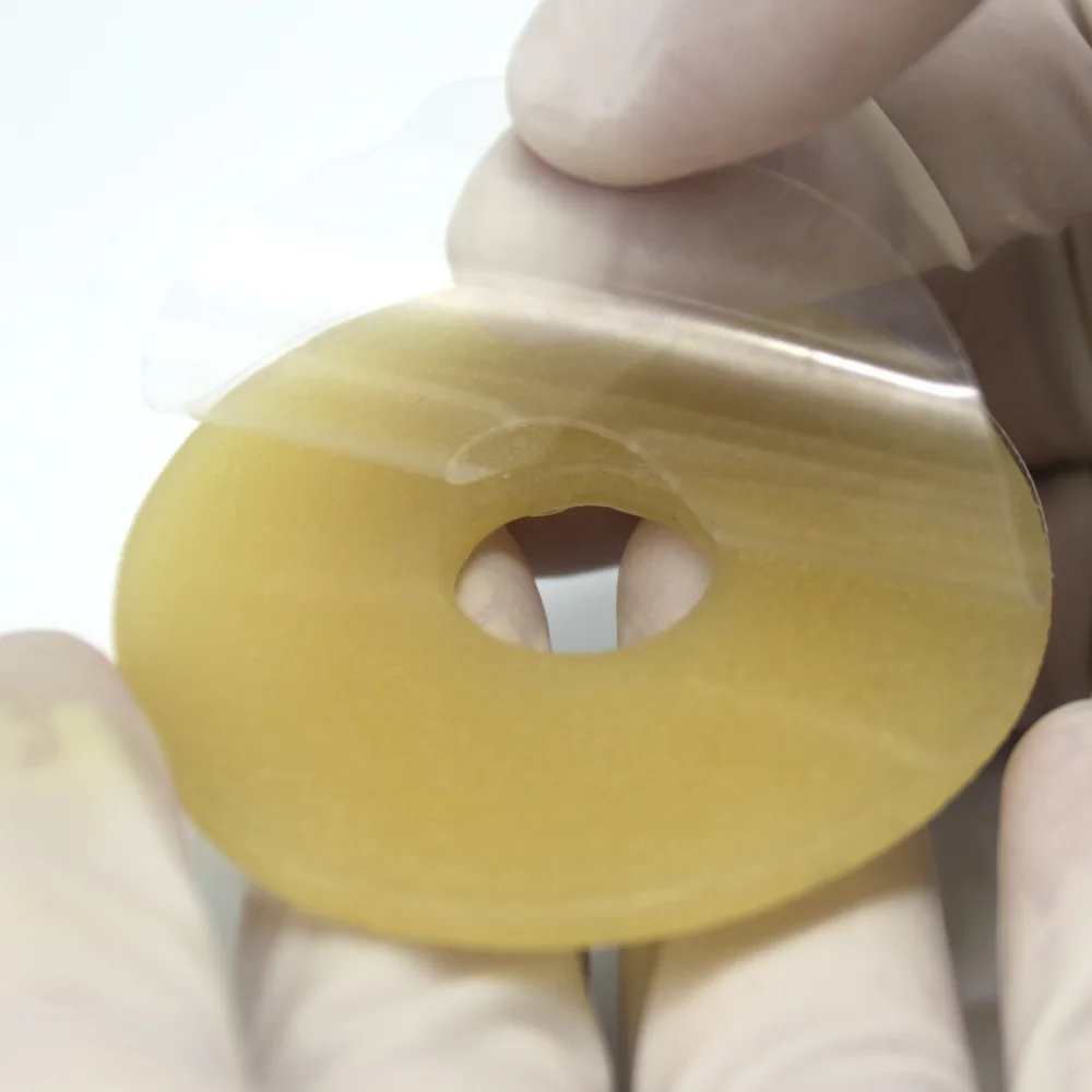 10pcs Moldable Colostomy Skin Barrier Ring 4mm Thickness for Ostomy Stoma Care Assistance 402A 4
