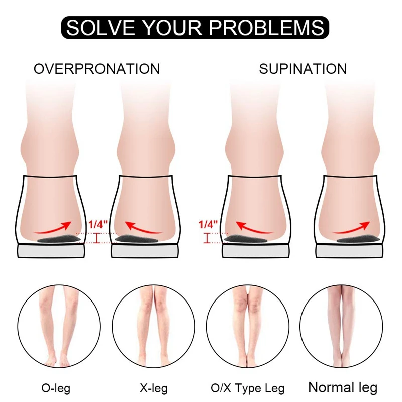Medial u0026 Lateral Heel Wedge Silicone Insoles For Supination And Pronation,  Corrective Adhesive Gel Shoe Inserts For Bow Legs, Fo - Insoles - AliExpress