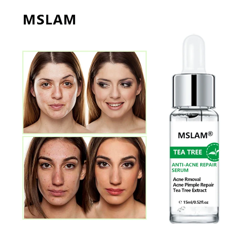 

MSLAM Tea Tree Anti-Acne Serum Acne Scars Treatment Moisturizing Anti-wrinkle Shrink Pore Essence Anti-oxidation Face Care
