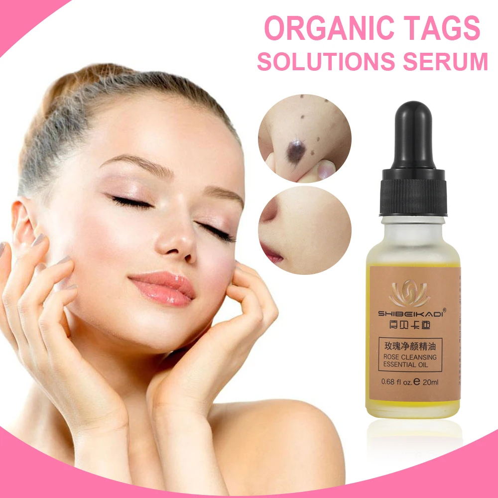 organic skin tag solution serum