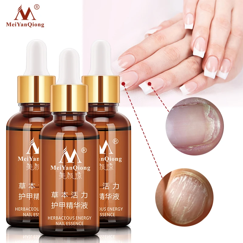 

3PCS Fungal Nail Treatment Feet Care Essence Nail Foot Whitening Toe Nail Fungus Anti Fungal Nail Infection Good Toenail 30ml