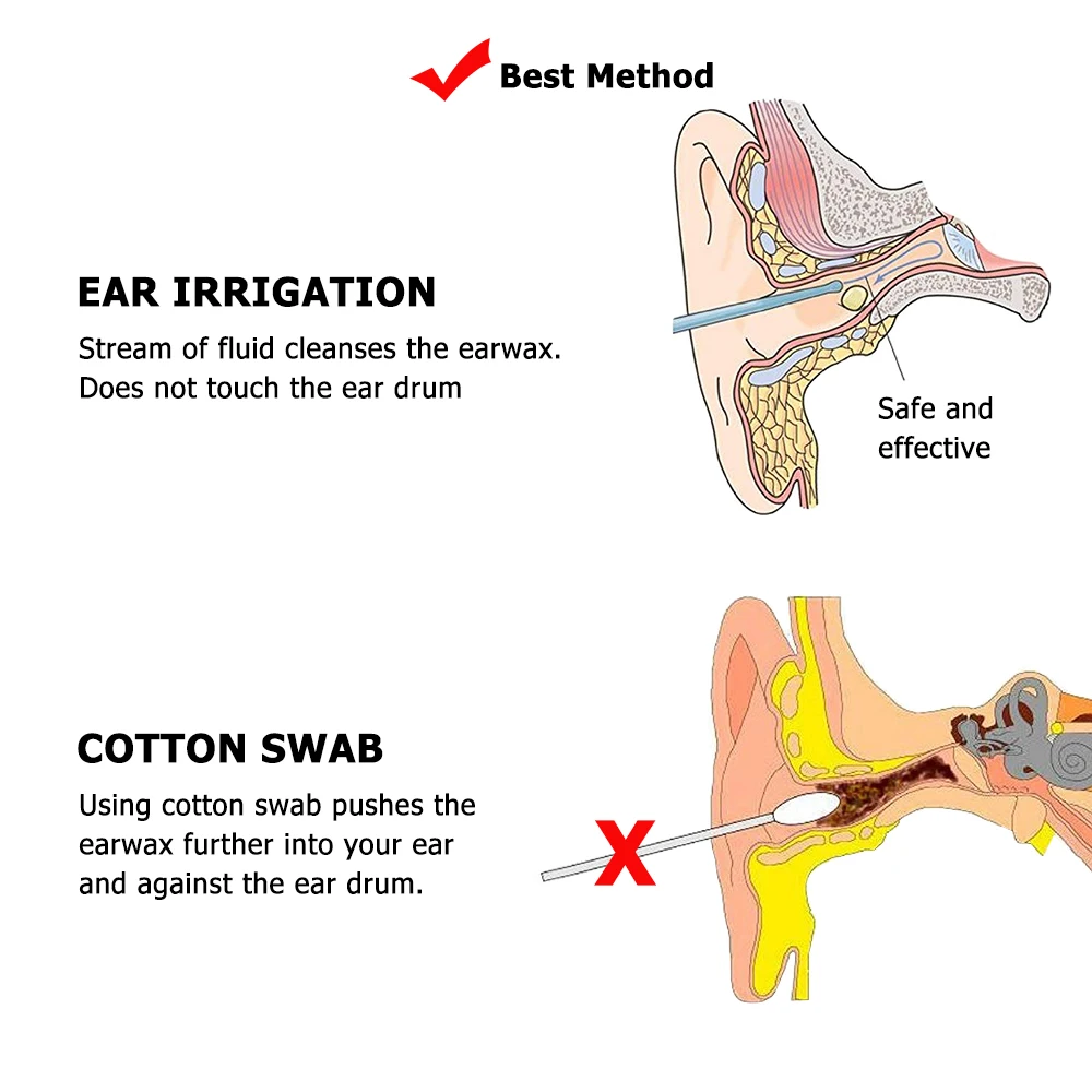 Dispositif de lavage d'oreille pour laver l'oreille percée, canal d'oreille  absorbant l'eau, dispositif de lavage d'oreille de rinçage, outil de  cueillette d'oreille, livres - AliExpress